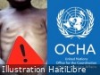 Haïti - FLASH : 21,500 enfants admis pour traitement de malnutrition aiguë sévère